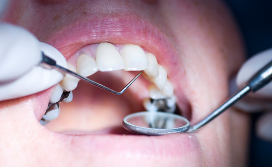 Examen dental photo