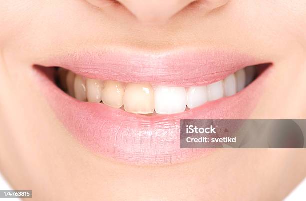 Przed I Po Wybielanie Zębów - zdjęcia stockowe i więcej obrazów Wybielać zęby - Wybielać zęby, Przed i potem, Technologia