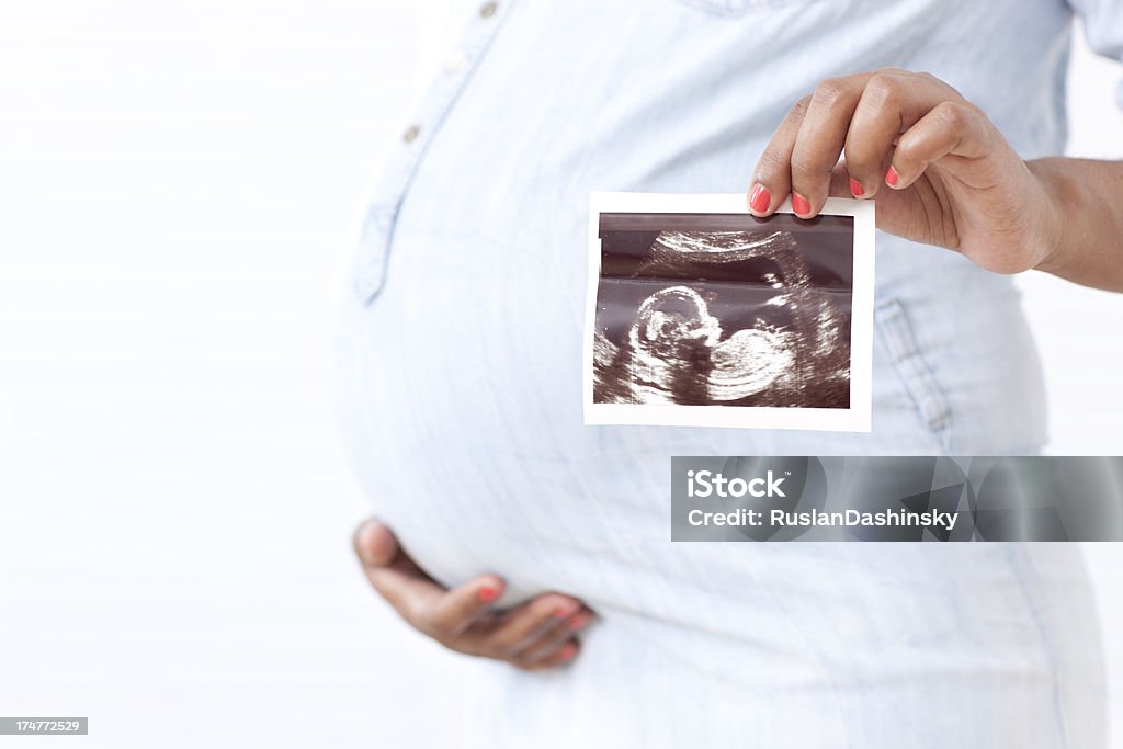 Donna incinta con ecografia. - Foto stock royalty-free di Donne