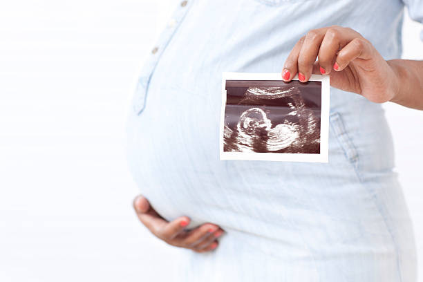 Pregnant woman showing ultrasound scan. "Pregnant woman showing ultrasound scan , isolated over white background. Copy space.Similar images preview:" ethiopian ethnicity photos stock pictures, royalty-free photos & images