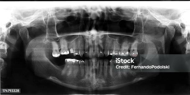 Xray Stock Photo - Download Image Now - Data, Dental Equipment, Front View