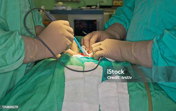 Doctors Are On An Operation Stock Photo - Download Image Now - Machinery, Surgery, Close-up