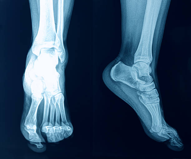 x-ray image des fußes - bending human foot ankle x ray image stock-fotos und bilder