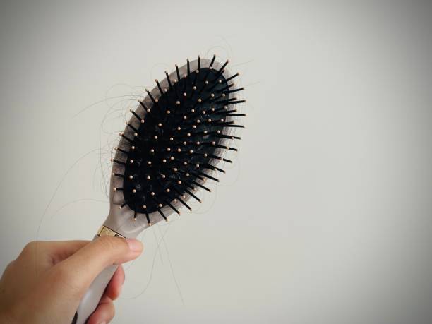 istock Hairbrush with Loss hair 1748143284