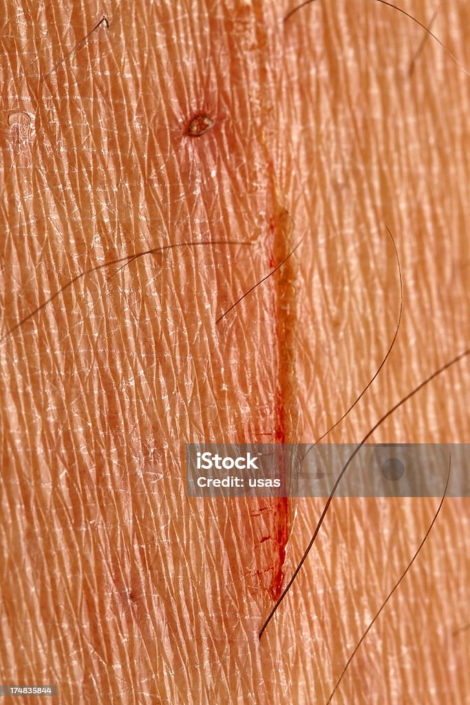 Cat's Scar do Homem perna. - Foto de stock de Adulto royalty-free