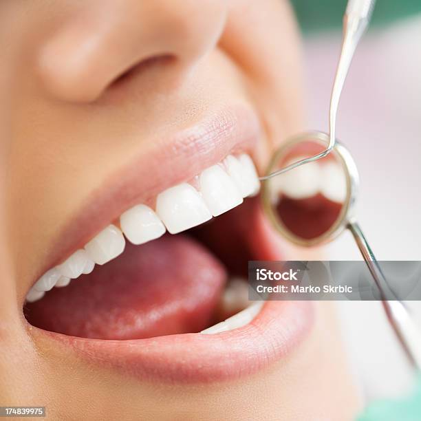 Primer Plano De Dentista Examen Foto de stock y más banco de imágenes de Abierto - Abierto, Abrir, Adulto
