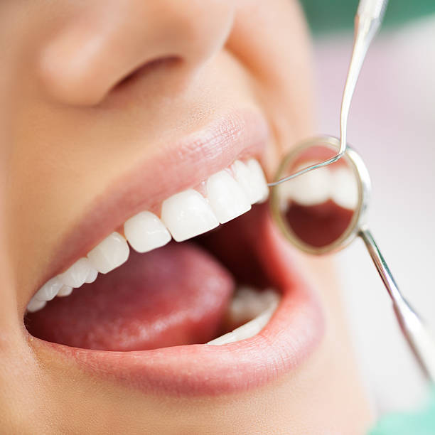 istock Close up of Dentist examination 174839975