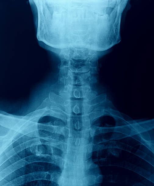 x 線画像 - x ray human neck animal spine human spine ストックフォトと画像