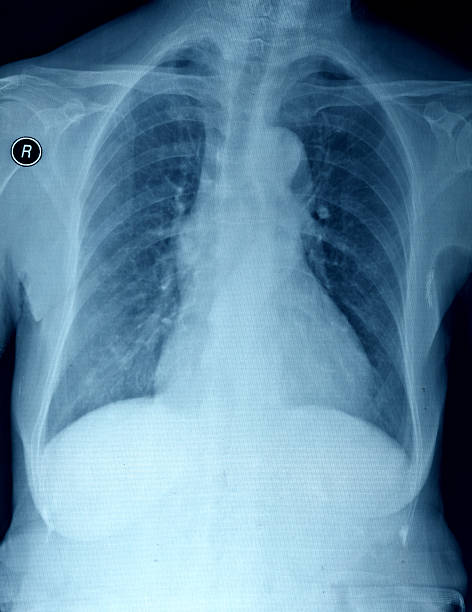 胸 x 線画像 - x ray human neck animal spine human spine ストックフォトと画像