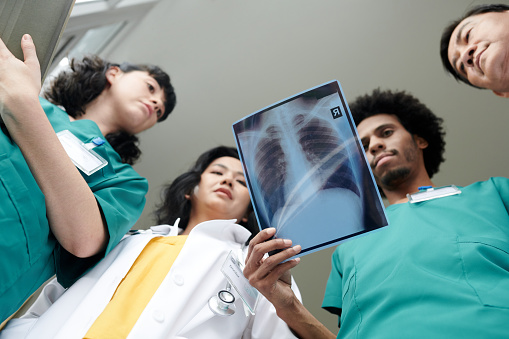 Group of medical workers looking at lungs x-ray image