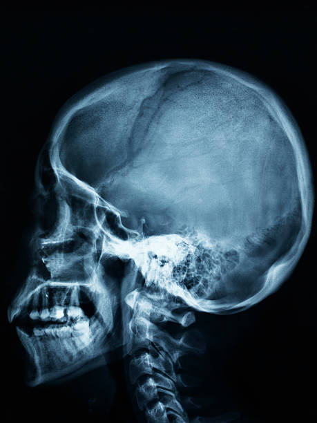 radiografia del cervello in capo - unknown gender foto e immagini stock