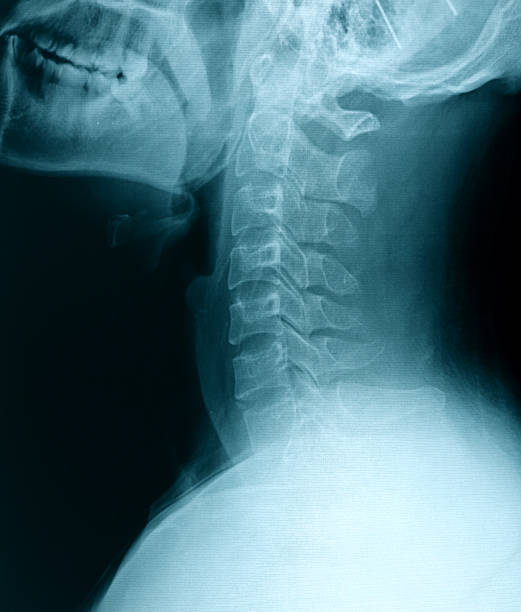 x 線画像 - x ray human neck animal spine human spine ストックフォトと画像