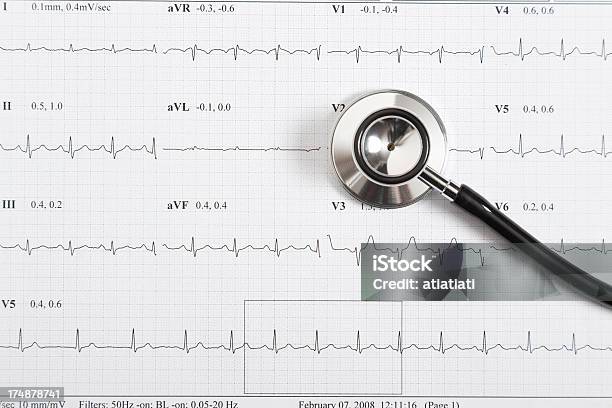 Electrocardiograma E Estetoscópio - Fotografias de stock e mais imagens de Machinery - Machinery, Ritmo Cardíaco, Branco