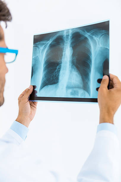 istock Doctor checking X-Ray of lungs 174879773