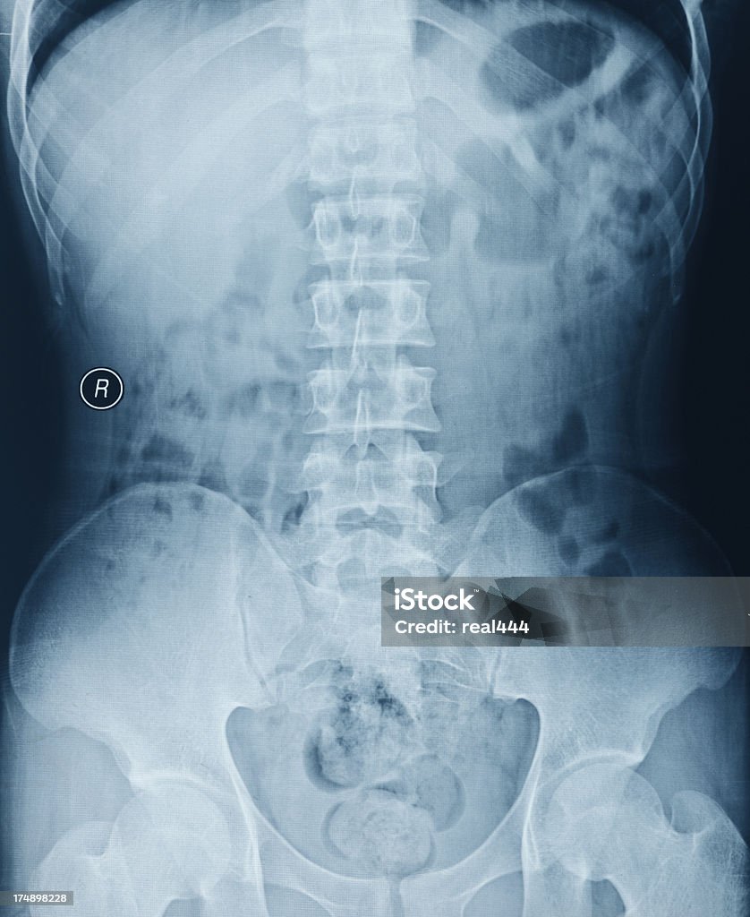 Una radiografía de tórax imagen - Foto de stock de Abdomen libre de derechos