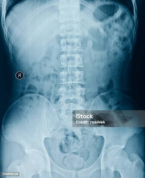 Una Radiografía De Tórax Imagen Foto de stock y más banco de imágenes de Abdomen - Abdomen, Abdomen humano, Anatomía