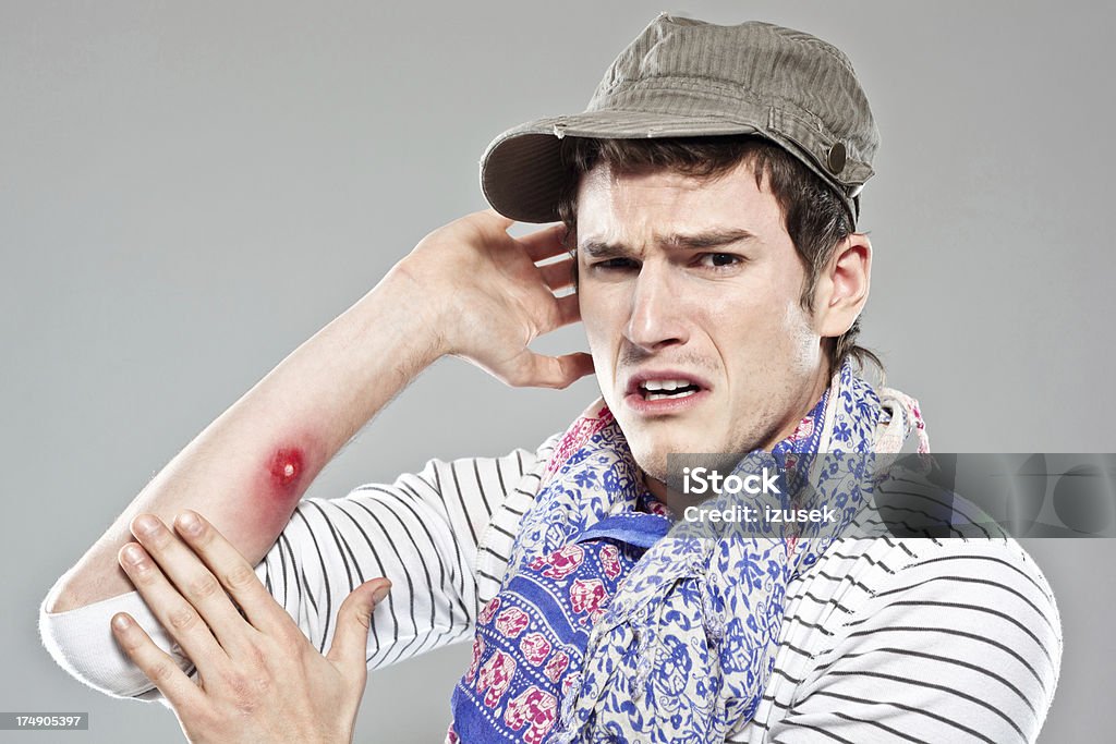 Backpacker showing mosquito bite Young adult male tourist showing a painfull insect bite on his arm. Men Stock Photo