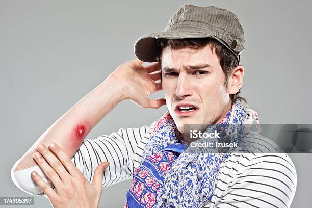 Backpacker Showing Mosquito Bite Stock Photo - Download Image Now - Men, Biting, Insect