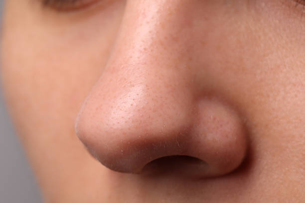 istock Young woman with acne problem, closeup view of nose 1749103388