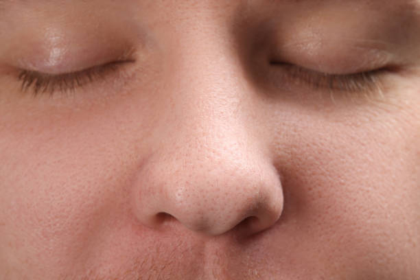 istock Young man with acne problem, closeup view of nose 1749103953