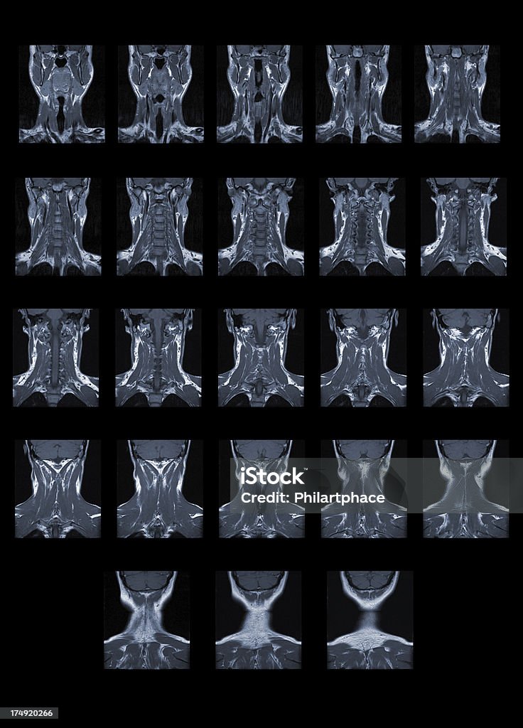 RMI Spina dorsale umana - Foto stock royalty-free di Composizione verticale