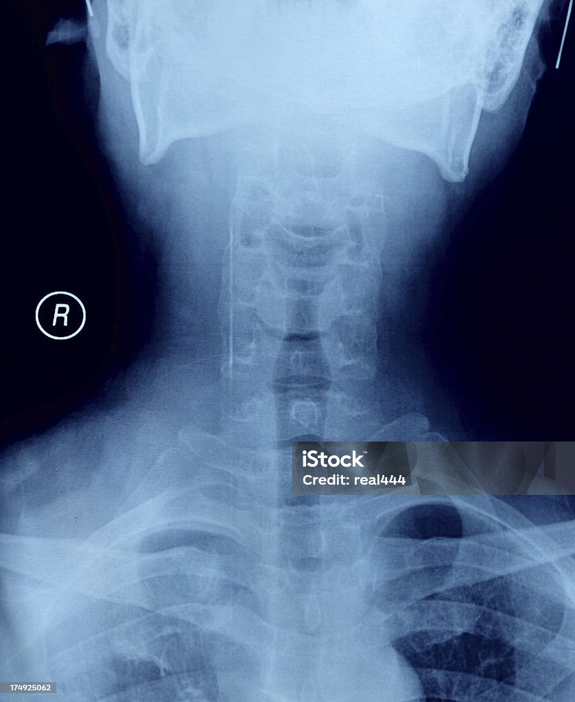X-선 영상 - 로열티 프리 X-레이 스톡 사진