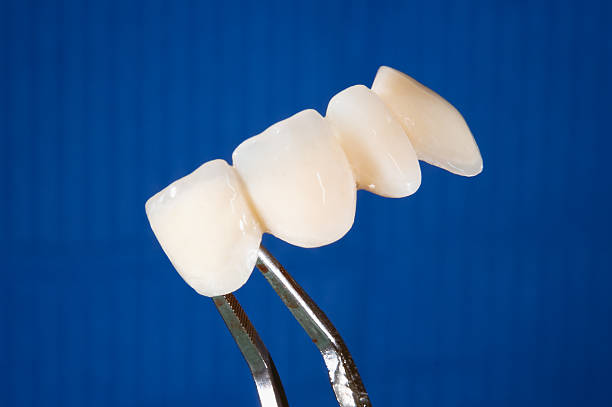 Object image of a medical dental impression with Euro currency bank notes