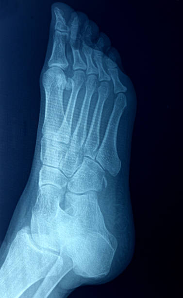 x-ray image des fußes - bending human foot ankle x ray image stock-fotos und bilder