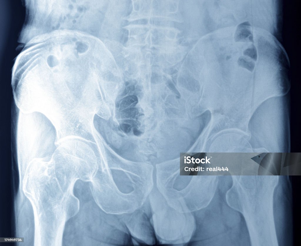 Xray - Lizenzfrei Anatomie Stock-Foto