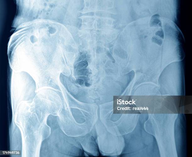 Xray Stockfoto und mehr Bilder von Anatomie - Anatomie, Bauch, Beleuchtet