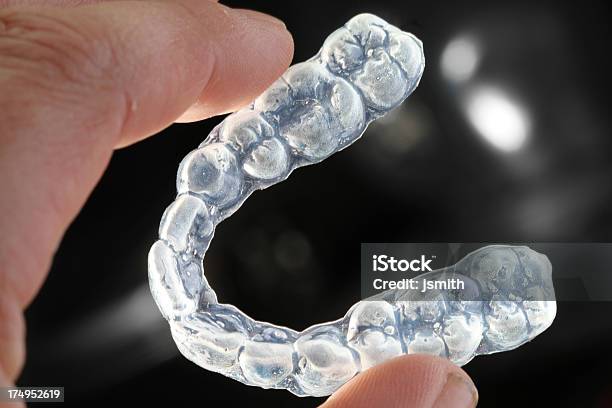 치아용 리테이너 치아 교정장치에 대한 스톡 사진 및 기타 이미지 - 치아 교정장치, 사랑니, 치아 미백
