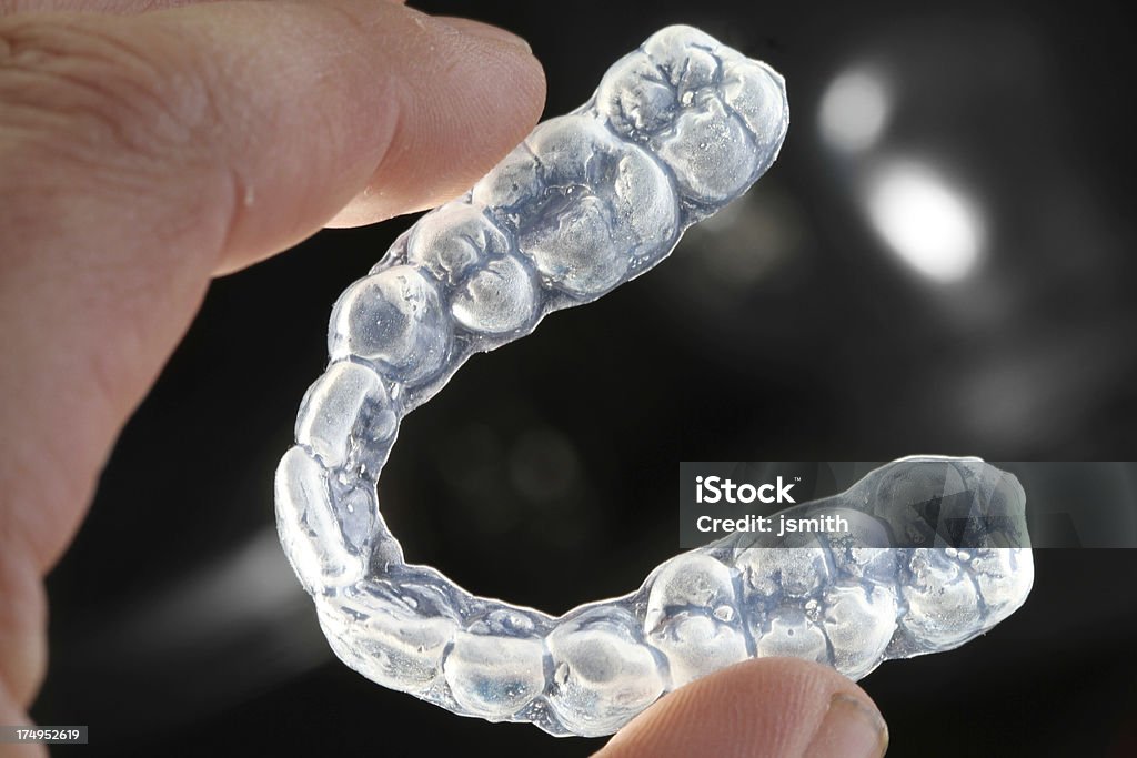 Dental retainers Dental retainers in hand on dark background Dental Aligner Stock Photo