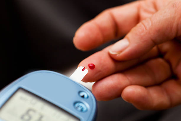 혈당 혈액 검사 - diabetes high up blood sugar test glucose 뉴스 사진 이미지