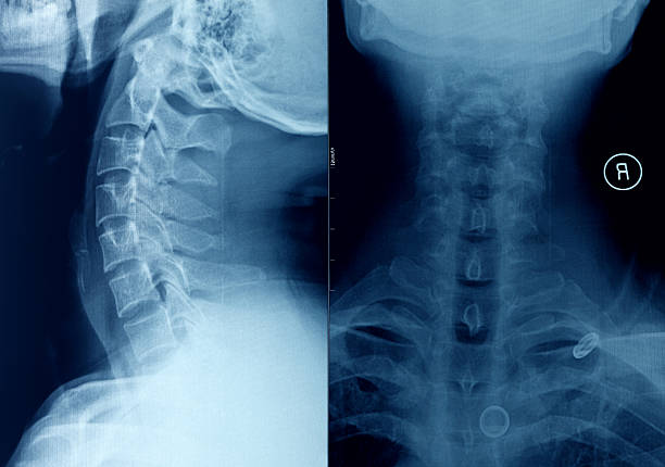 xray humano coluna cervical - skullpan imagens e fotografias de stock