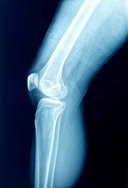 knie anatomie knochen menschliches bein x-ray - bending human foot ankle x ray image stock-fotos und bilder