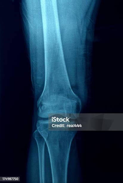 Knie Anatomie Knochen Menschliches Bein Xray Stockfoto und mehr Bilder von Anatomie - Anatomie, Arthritis, Beinknochen