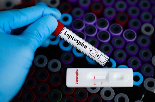 Blood sample of patient negative tested for leptospira by rapid diagnostic test.