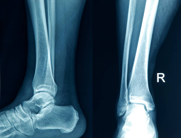 x-ray image des fußes - bending human foot ankle x ray image stock-fotos und bilder