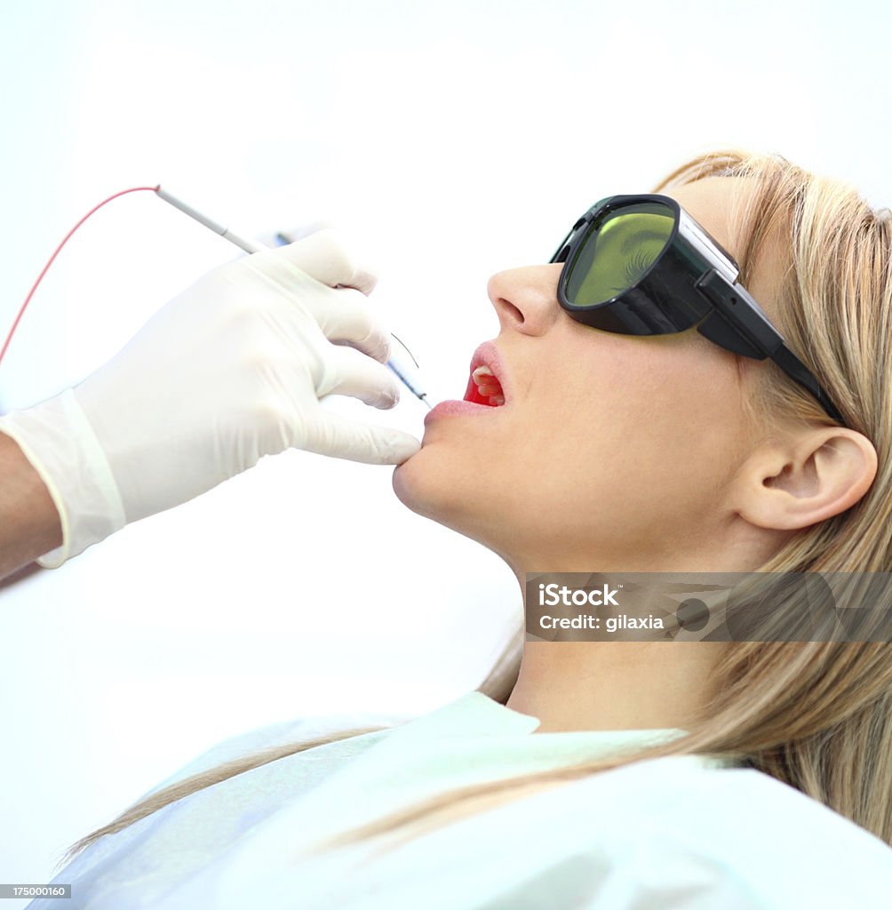 Zahnärztlichen Behandlung mit laser. - Lizenzfrei Laserlicht Stock-Foto