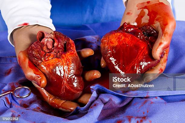 心臓移植動作 - ヒトの内臓のストックフォトや画像を多数ご用意 - ヒトの内臓, ヘルスケアと医療, 二つ