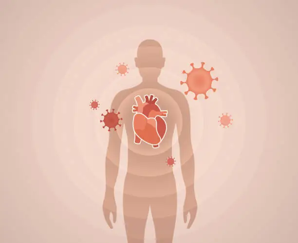 Vector illustration of Covid Heart Problems Inflammation Myocarditis
