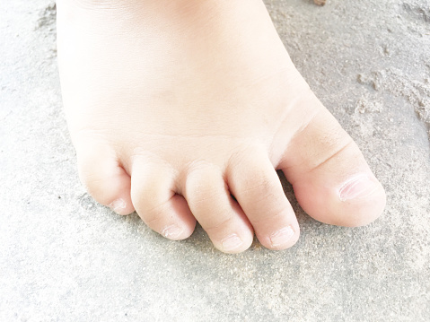 A toddler's dirty feet.