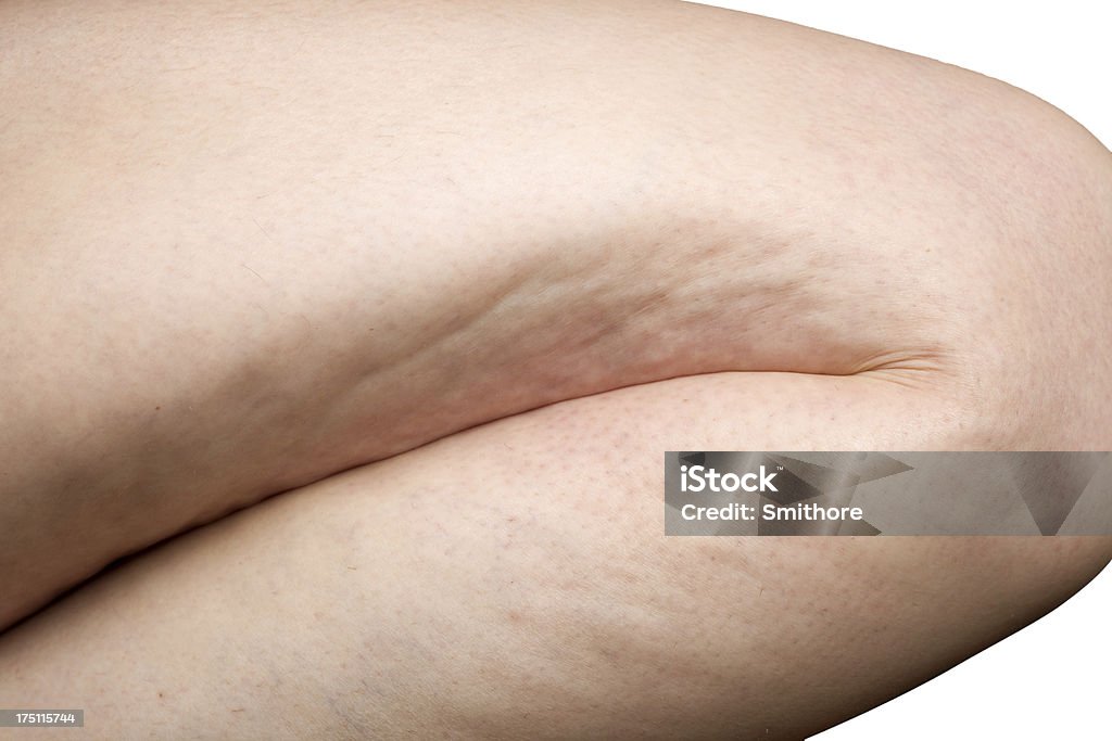 woman leg cellulite detail of cellulite on woman leg isolated on white Cellulite Stock Photo