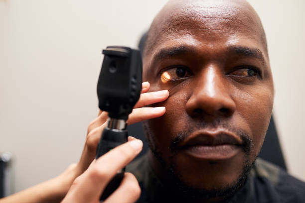 istock Eye exam, microscope and man with doctor, optometrist and tool for vision and healthcare. Ophthalmology, wellness and hands test or check patient for optical glaucoma with medical equipment in clinic 1751619921