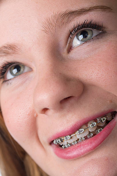 istock Teenager With Teeth Braces 175169701