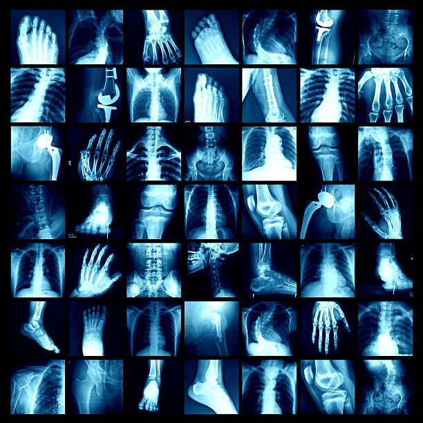 x-ray - bending human foot ankle x ray image stock-fotos und bilder