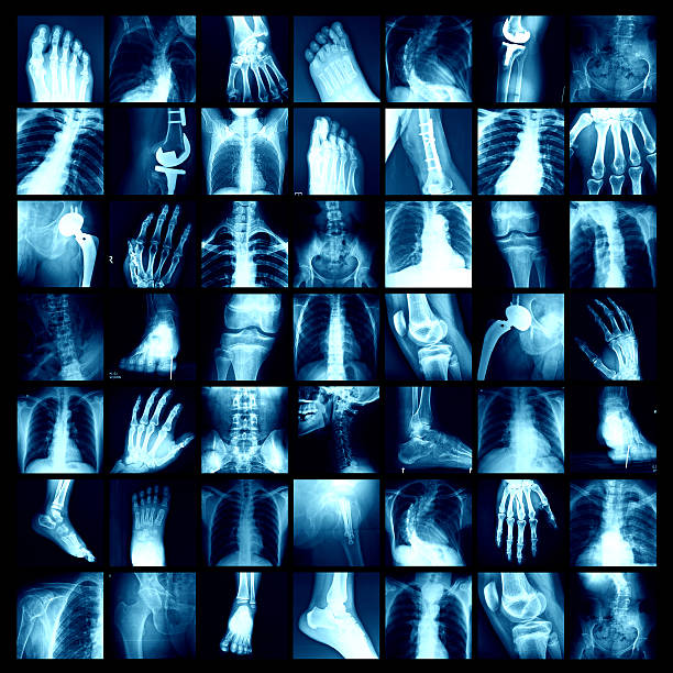x-ray - human lung x ray image x ray human spine - fotografias e filmes do acervo