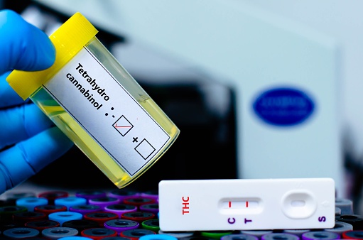 Blood sample of patient negative for tetrahydrocannabinol(THC) by rapid diagnostic test.