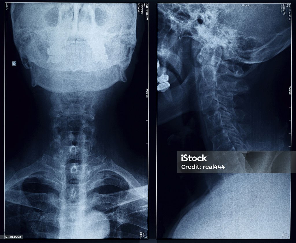 X-ray image Anatomy Stock Photo