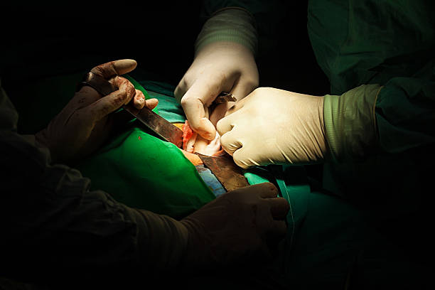 鼠径ヘルニア手術 - gauze scalpel surgeon healthcare and medicine ストックフォトと画像